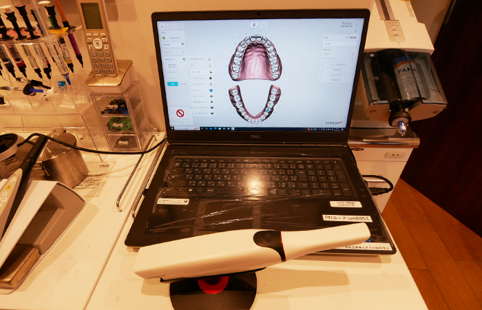 口腔内3Dスキャナー
